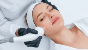 Why Is a Mons Lift More Reliable for Sagging Skin Than Laser-Based Treatments Explained
